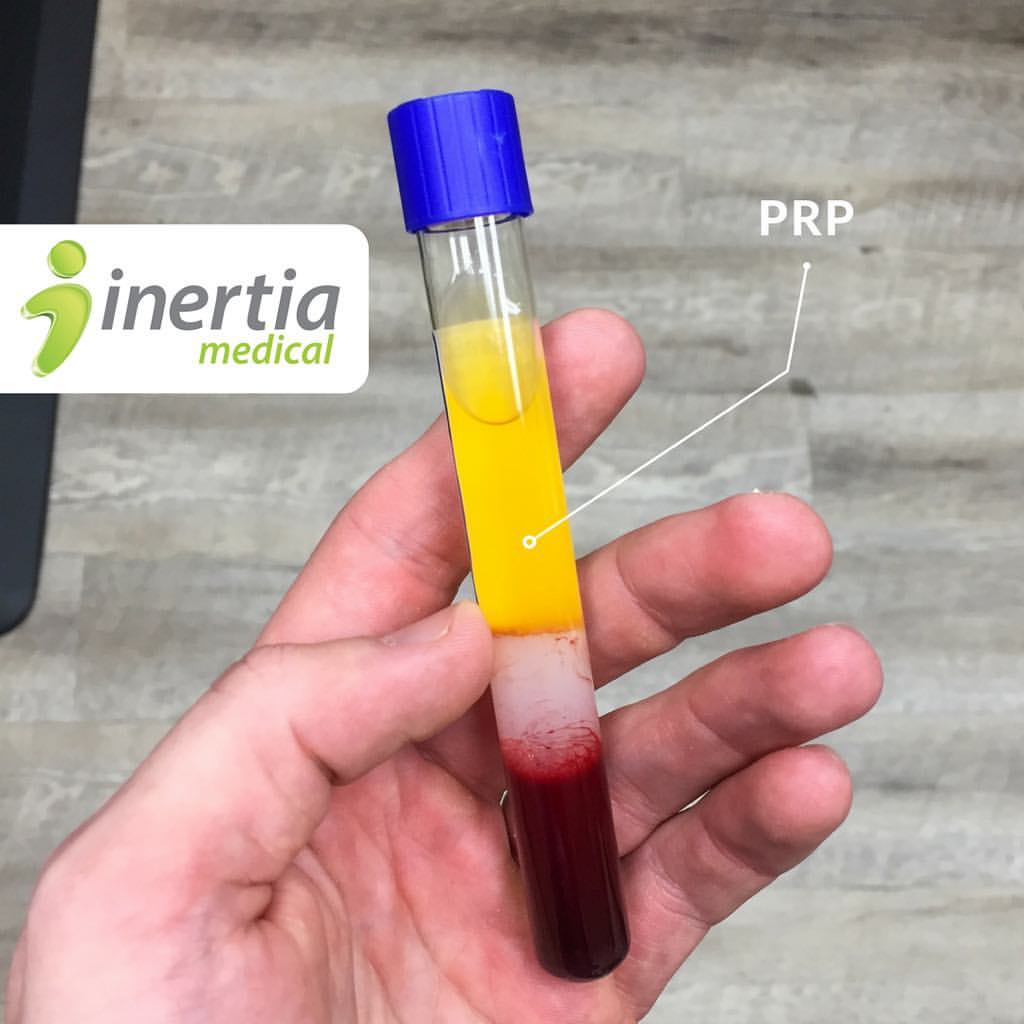 Rich plasma. PRP плазма. С жёлтой крышкой подходит для PRP.